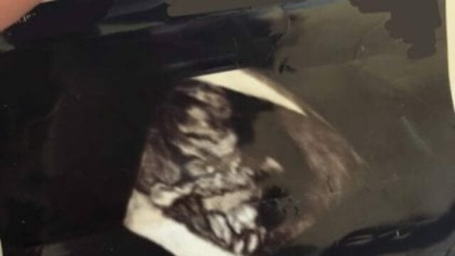 Shay Mitchell ha rivelato in alcune story di Instagram di aver subito un aborto spontaneo nel corso del 2018, ecco i dettagli
